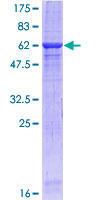 ERBB3 / HER3 Protein - 12.5% SDS-PAGE of human ERBB3 stained with Coomassie Blue