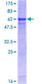 ERBB3 / HER3 Protein - 12.5% SDS-PAGE of human ERBB3 stained with Coomassie Blue