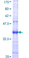ERBB3 / HER3 Protein - 12.5% SDS-PAGE Stained with Coomassie Blue.