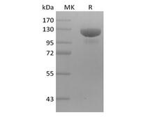 ERBB3 / HER3 Protein - Recombinant Human Receptor Tyrosine-Protein Kinase ErbB-3/HER3 (C-mFc)