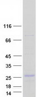 ERBB3 / HER3 Protein - Purified recombinant protein ERBB3 was analyzed by SDS-PAGE gel and Coomassie Blue Staining