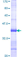 ERBB4 / HER4 Protein - 12.5% SDS-PAGE Stained with Coomassie Blue.