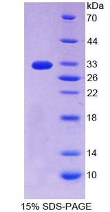 ERBB4 / HER4 Protein - Recombinant  V-Erb A Erythroblastic Leukemia Viral Oncogene Homolog 4 By SDS-PAGE