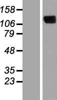 ERC2 / CAST1 Protein - Western validation with an anti-DDK antibody * L: Control HEK293 lysate R: Over-expression lysate