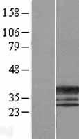 ERCC1 Protein - Western validation with an anti-DDK antibody * L: Control HEK293 lysate R: Over-expression lysate