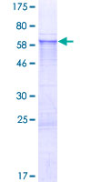 ERCC1 Protein - 12.5% SDS-PAGE of human ERCC1 stained with Coomassie Blue