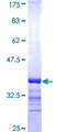 ERCC1 Protein - 12.5% SDS-PAGE Stained with Coomassie Blue.