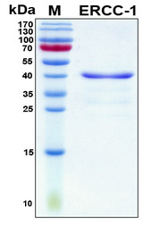 ERCC1 Protein
