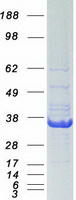 ERCC1 Protein - Purified recombinant protein ERCC1 was analyzed by SDS-PAGE gel and Coomassie Blue Staining