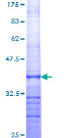 ERCC2 / XPD Protein - 12.5% SDS-PAGE Stained with Coomassie Blue.