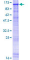 ERCC3 / XPB Protein - 12.5% SDS-PAGE of human ERCC3 stained with Coomassie Blue