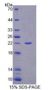 ERCC3 / XPB Protein - Recombinant Xeroderma Pigmentosum, Complementation Group B (XPB) by SDS-PAGE
