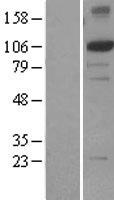 ERCC4 / XPF Protein - Western validation with an anti-DDK antibody * L: Control HEK293 lysate R: Over-expression lysate