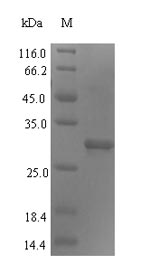 ERCC5 / XPG Protein - (Tris-Glycine gel) Discontinuous SDS-PAGE (reduced) with 5% enrichment gel and 15% separation gel.