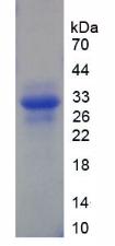 ERCC5 / XPG Protein - Recombinant Xeroderma Pigmentosum, Complementation Group G By SDS-PAGE