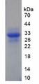 ERCC5 / XPG Protein - Recombinant Xeroderma Pigmentosum, Complementation Group G By SDS-PAGE