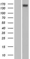 ERCC6 / CSB Protein - Western validation with an anti-DDK antibody * L: Control HEK293 lysate R: Over-expression lysate