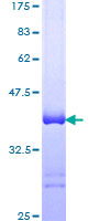 ERCC6 / CSB Protein - 12.5% SDS-PAGE Stained with Coomassie Blue.