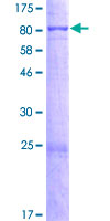 ERCC6L2 Protein - 12.5% SDS-PAGE of human LOC375748 stained with Coomassie Blue