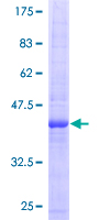 EREG / Epiregulin Protein - 12.5% SDS-PAGE of human EREG stained with Coomassie Blue