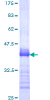EREG / Epiregulin Protein - 12.5% SDS-PAGE Stained with Coomassie Blue.