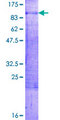 ERF / PE2 Protein - 12.5% SDS-PAGE of human ERF stained with Coomassie Blue