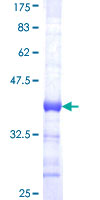 ERF / PE2 Protein - 12.5% SDS-PAGE Stained with Coomassie Blue.