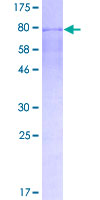 ERG Protein - 12.5% SDS-PAGE of human ERG stained with Coomassie Blue