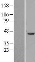 ERG1 / SQLE Protein - Western validation with an anti-DDK antibody * L: Control HEK293 lysate R: Over-expression lysate