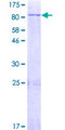 ERG1 / SQLE Protein - 12.5% SDS-PAGE of human SQLE stained with Coomassie Blue