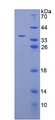 ERGIC-53 / LMAN1 Protein - Recombinant Lectin, Mannose Binding 1 By SDS-PAGE
