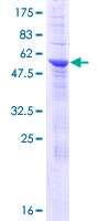 ERGIC1 Protein - 12.5% SDS-PAGE of human ERGIC1 stained with Coomassie Blue