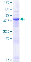 ERGIC2 Protein - 12.5% SDS-PAGE of human ERGIC2 stained with Coomassie Blue
