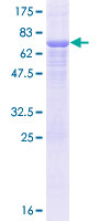 ERGIC3 Protein - 12.5% SDS-PAGE of human ERGIC3 stained with Coomassie Blue