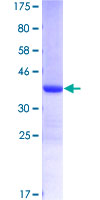 ERH Protein - 12.5% SDS-PAGE of human ERH stained with Coomassie Blue