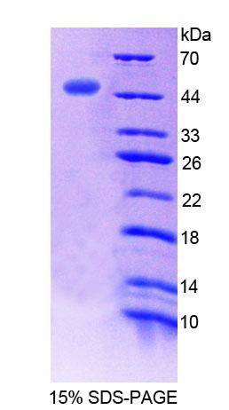 ERI1 / HEXO Protein - Recombinant Exoribonuclease 1 (ERI1) by SDS-PAGE