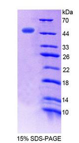 ERI1 / HEXO Protein - Recombinant Exoribonuclease 1 (ERI1) by SDS-PAGE