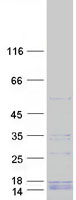 ERI1 / HEXO Protein - Purified recombinant protein ERI1 was analyzed by SDS-PAGE gel and Coomassie Blue Staining