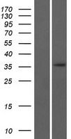 ERI3 Protein - Western validation with an anti-DDK antibody * L: Control HEK293 lysate R: Over-expression lysate