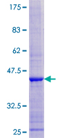 ERI3 Protein - 12.5% SDS-PAGE of human PRNPIP stained with Coomassie Blue