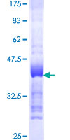 ERIC-1 / TACC3 Protein - 12.5% SDS-PAGE Stained with Coomassie Blue.