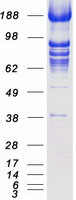 ERIC-1 / TACC3 Protein - Purified recombinant protein TACC3 was analyzed by SDS-PAGE gel and Coomassie Blue Staining