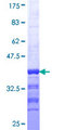 ERMAP / SC Protein - 12.5% SDS-PAGE Stained with Coomassie Blue.