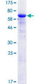 ERMN / Juxtanodin Protein - 12.5% SDS-PAGE of human KIAA1189 stained with Coomassie Blue