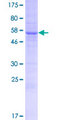 ERMP1 Protein - 12.5% SDS-PAGE of human ERMP1 stained with Coomassie Blue
