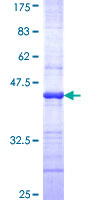 ERN1 / IRE1 Protein - 12.5% SDS-PAGE Stained with Coomassie Blue.