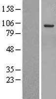 ERN2 Protein - Western validation with an anti-DDK antibody * L: Control HEK293 lysate R: Over-expression lysate