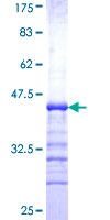 ERO1A / ERO1L Protein - 12.5% SDS-PAGE Stained with Coomassie Blue.