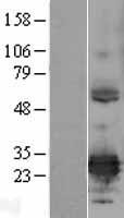 ERP29 Protein - Western validation with an anti-DDK antibody * L: Control HEK293 lysate R: Over-expression lysate