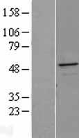 ERP44 Protein - Western validation with an anti-DDK antibody * L: Control HEK293 lysate R: Over-expression lysate